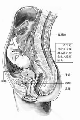 孕妇结构图