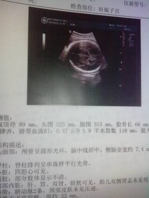 胎儿35周发育标准数值