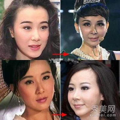 女性颧骨高面相