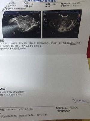 怀孕一个半月可以药流吗