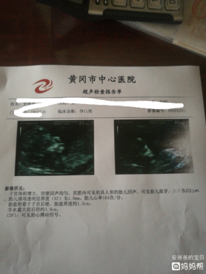 去医院检查是否怀孕要空腹吗
