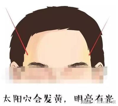 额头两侧发黑是怎么回事
