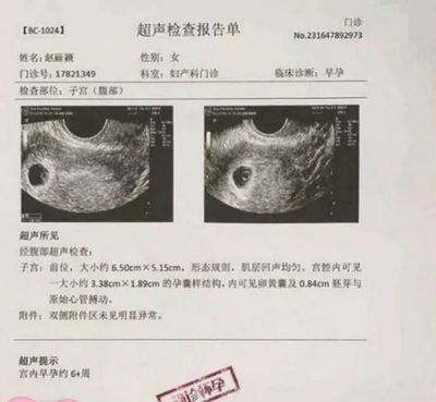3月怀孕预产期是几月