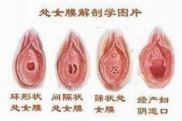 射进去怎么才能不怀孕