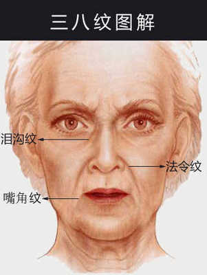 嘴角八字纹怎么消除