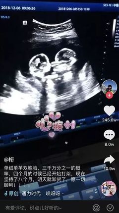 疤痕子宫可以怀双胞胎吗