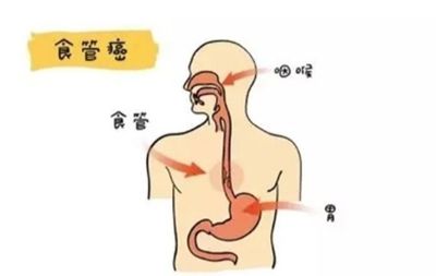 食道疼是怎么回事