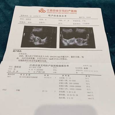 什么检查能查出怀孕
