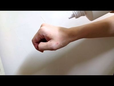 挤痘痘组织液挤很多