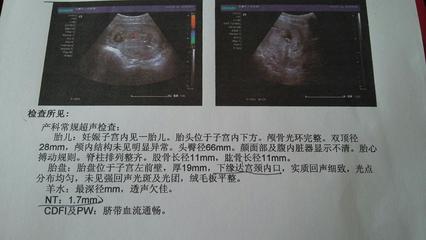 怀孕三个月怎么看男女