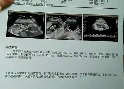 胎儿22周图片
