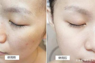 三七美容祛斑怎么使用