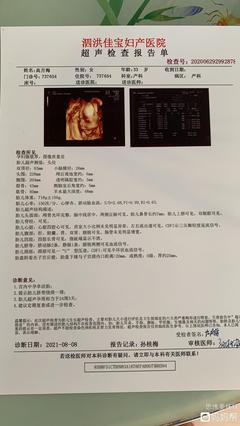 胎儿24周体重