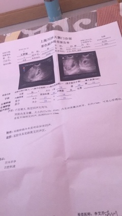 怀孕有宫腔积液