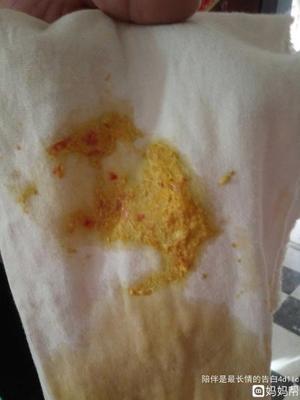 大便出好多血是怎么回事
