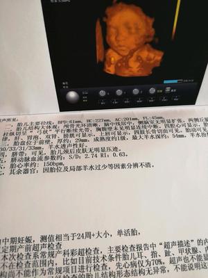 怀孕多久可以鉴定男女