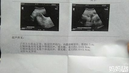 卵泡多大才能怀孕