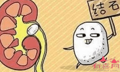 肾结石影响怀孕吗