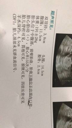 怀孕十七周有胎动吗