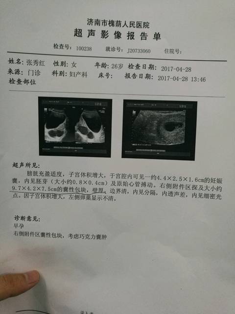 什么检查能查出怀孕