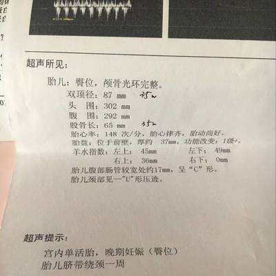 孕36周后胎儿一周一般能长重