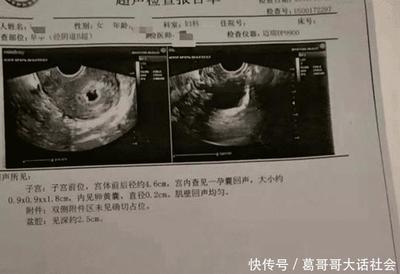 结扎三年了还会怀孕吗