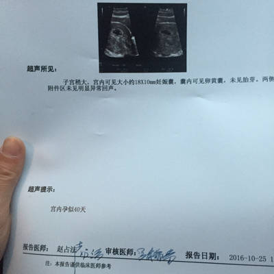 怀孕5个月打胎