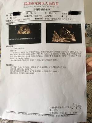 怀孕12周胎儿会动吗