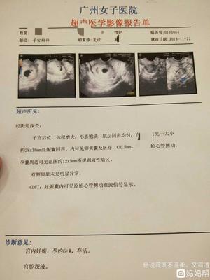 宫腔积液可以怀孕吗