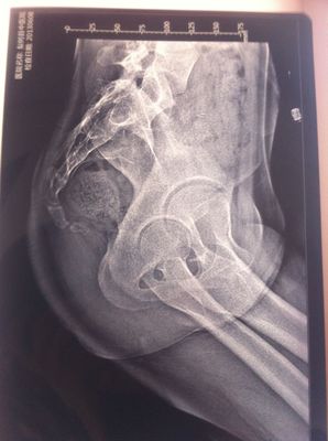 新生儿尾骨正常图片