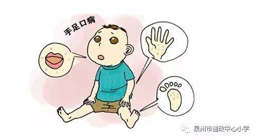 四肢发凉是怎么回事