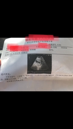 怀孕十一周胎儿会动吗