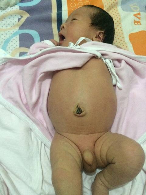 宝宝肚子鼓鼓的正常吗