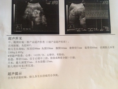 胎儿后期一周长多少斤