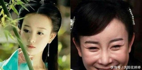 猪鼻面相