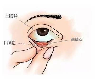 眼睛有重影是怎么回事