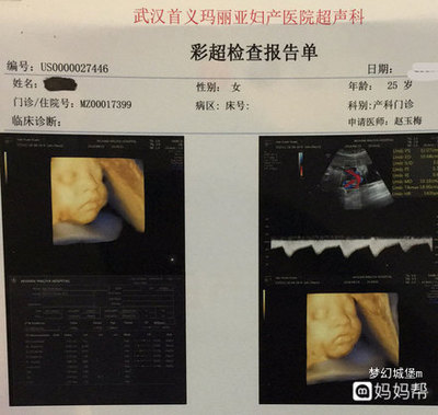 玛利亚检查多少钱