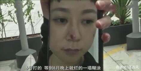 鼻子烂是怎么回事