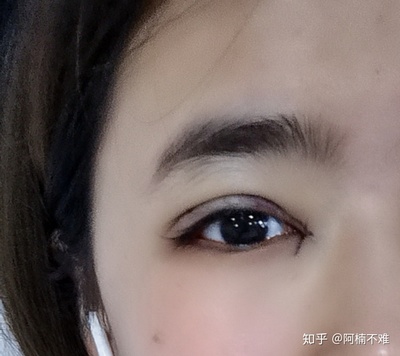 双眼皮忌口多久