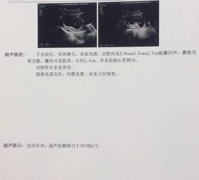 怎么算怀孕几周
