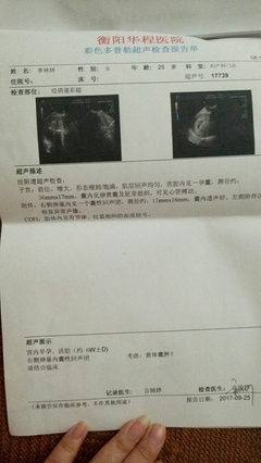 怀孕五周孕吐正常吗