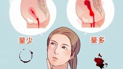 半个月就来一次月经怎么回事