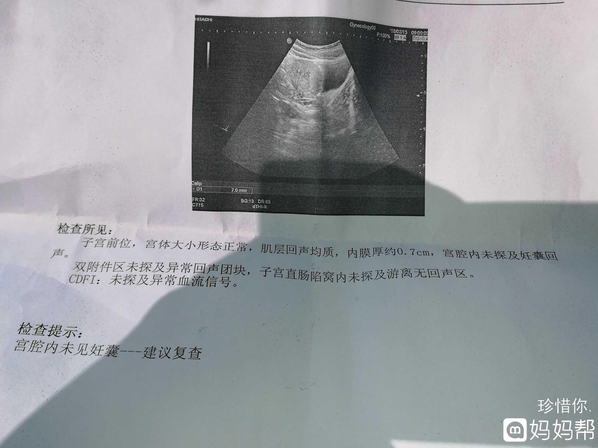 做dr后多久可以怀孕