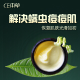 祛痘霜哪个产品好