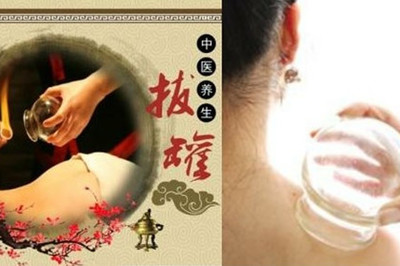 拔罐减肥减的是什么