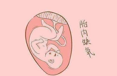 如何知道胎儿是否缺氧