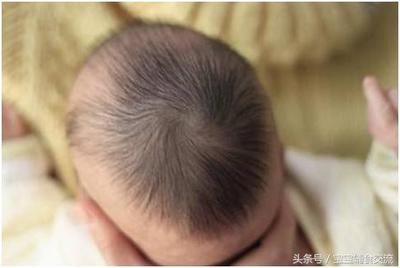 宝宝头发稀少是什么原因