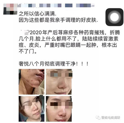 产后脸上长痘痘用什么药