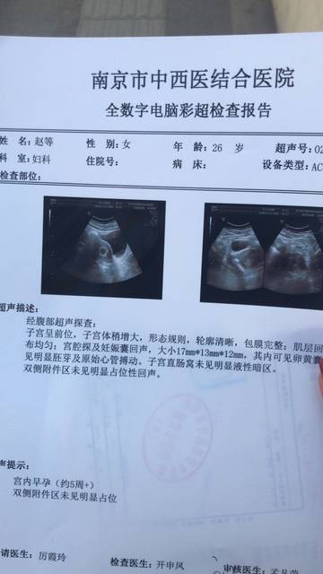刚怀孕要检查什么