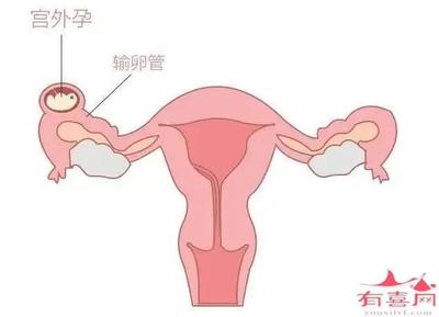 怀孕几率是多少